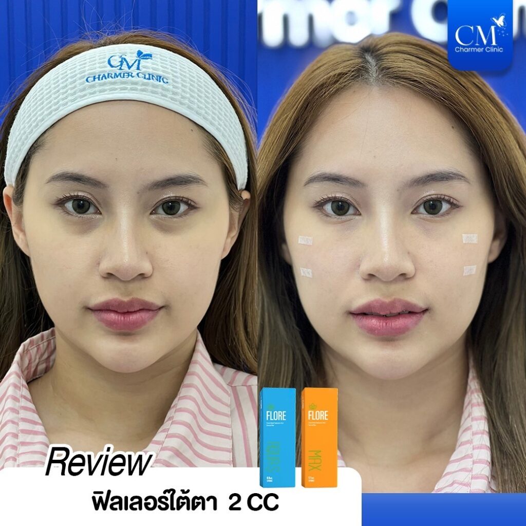 LINE_ALBUM_Graphic-2_๒๓๑๐๑๙_1-1024x1024