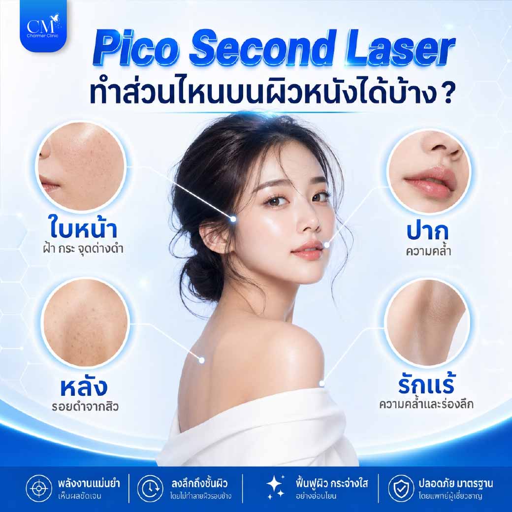 皮秒激光