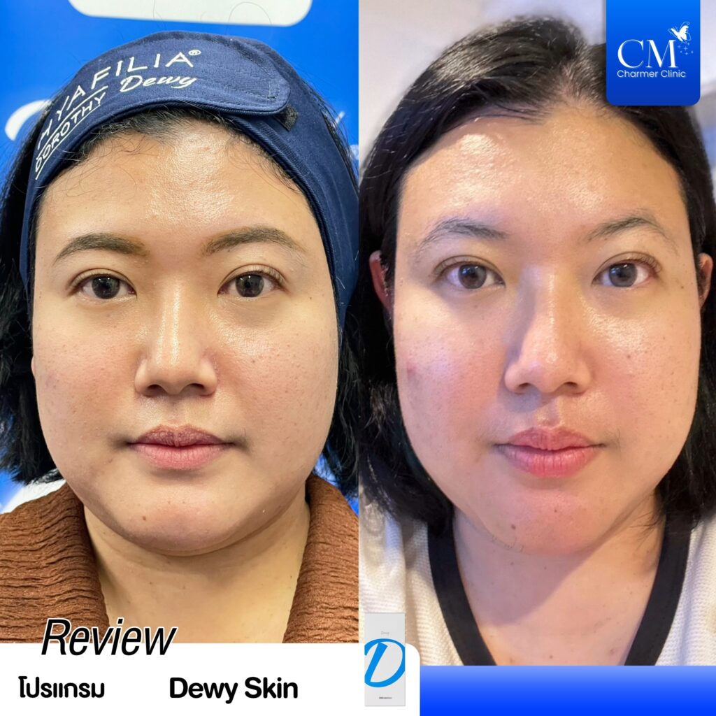 Review Dorathy Dewy