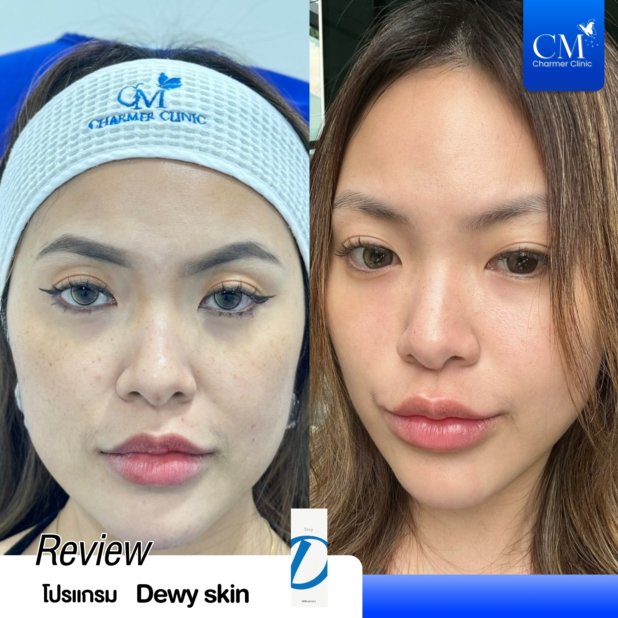 Review Dorathy Dewy