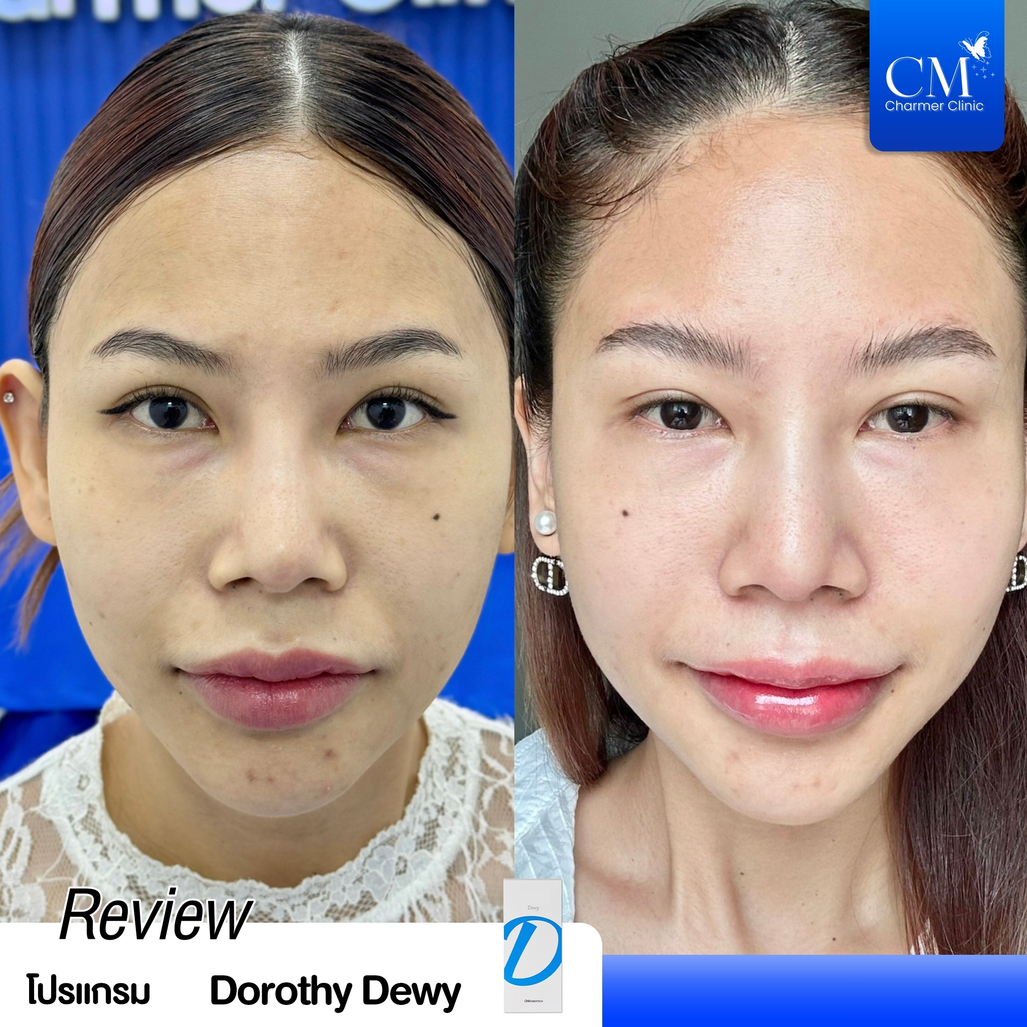 Review Dorathy Dewy