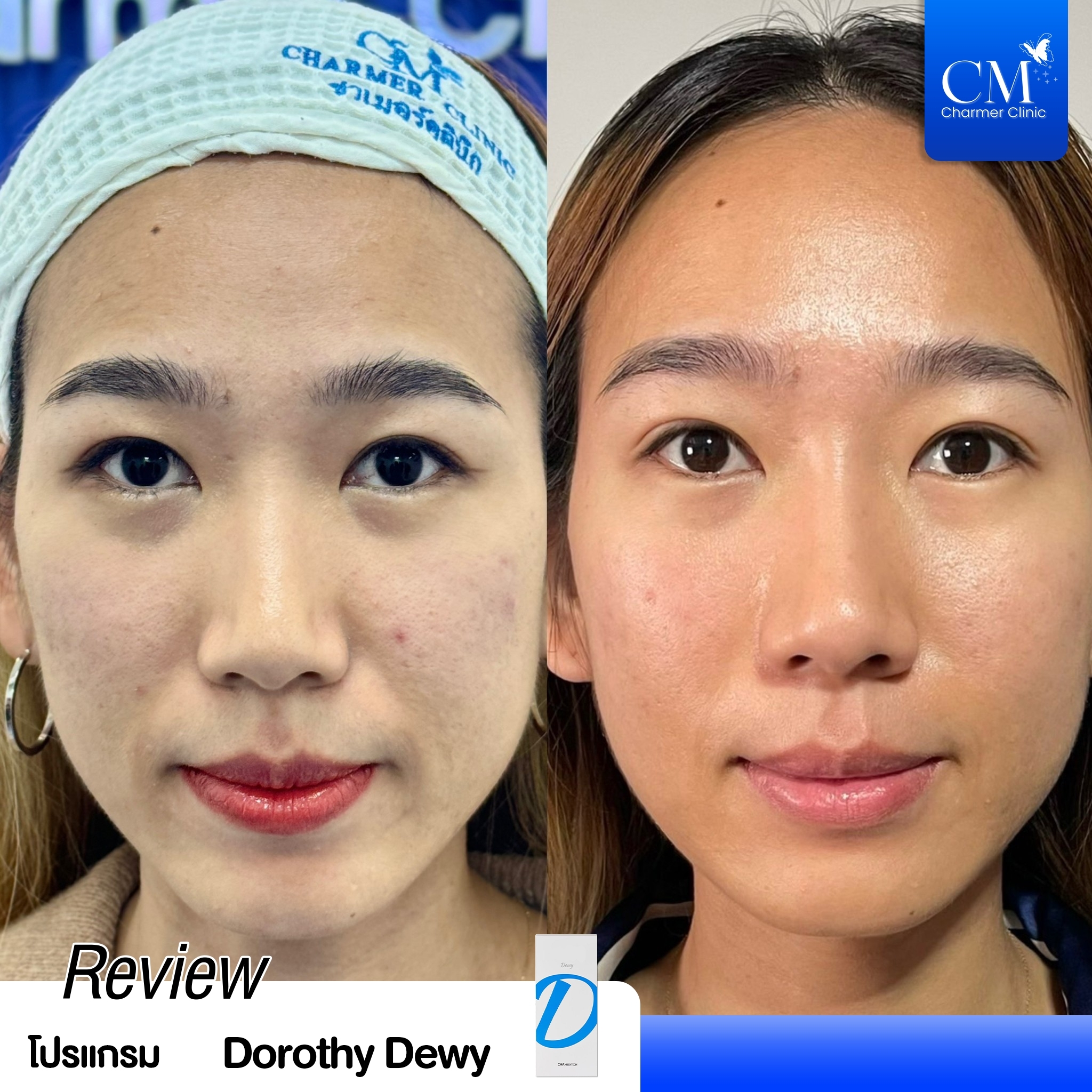 Review Dorathy Dewy