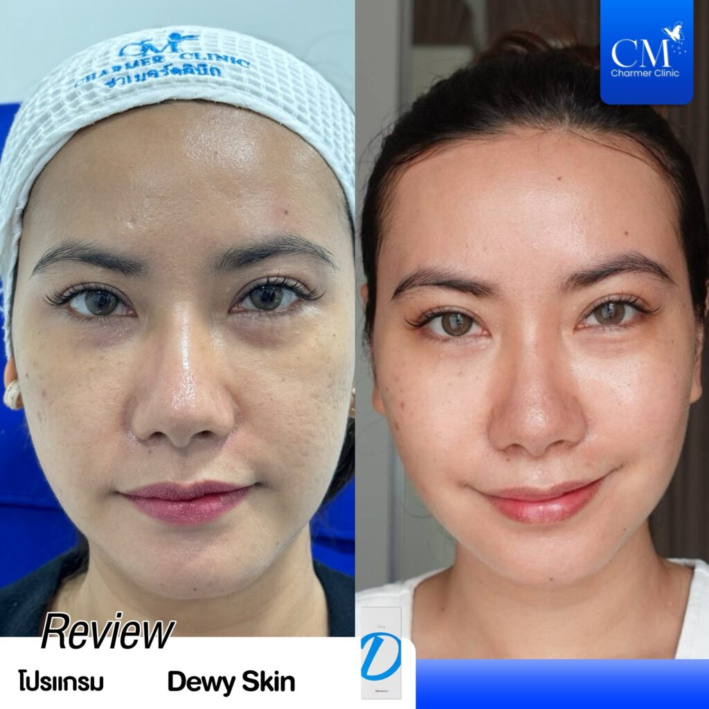 Review Dorathy Dewy