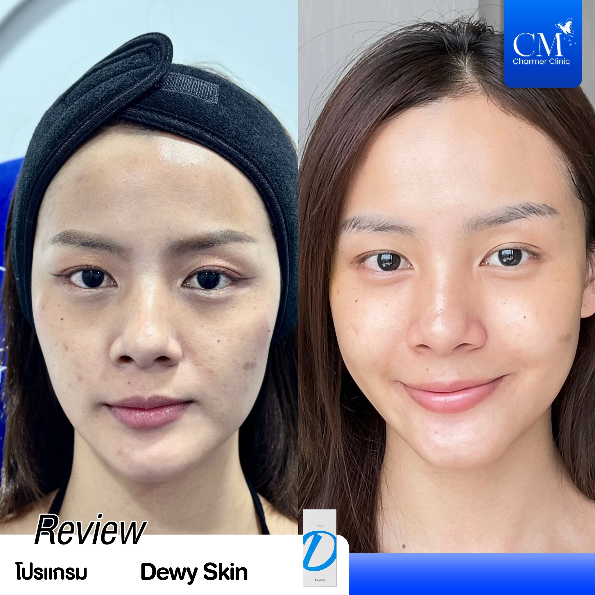Review Dorathy Dewy