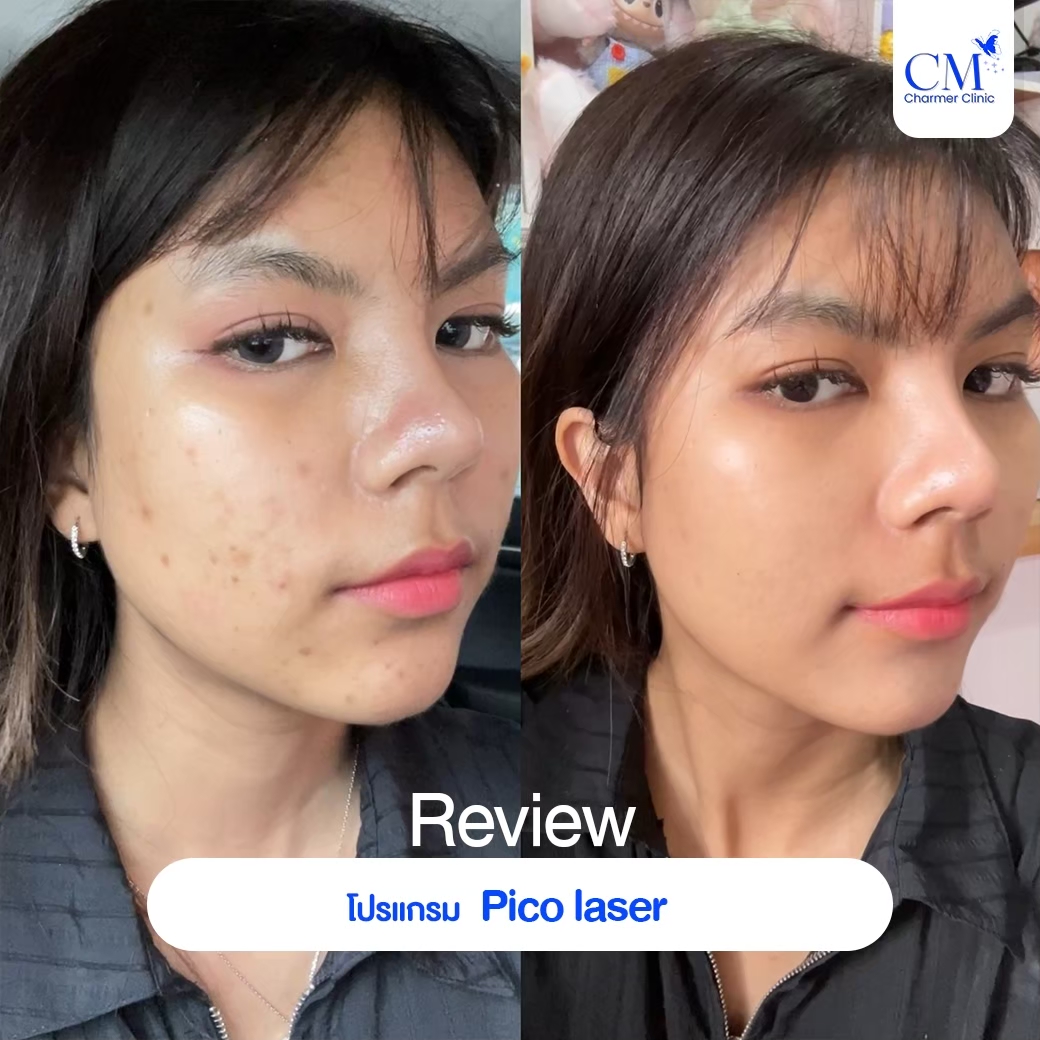 LINE_ALBUM_Graphic benz_250203_13