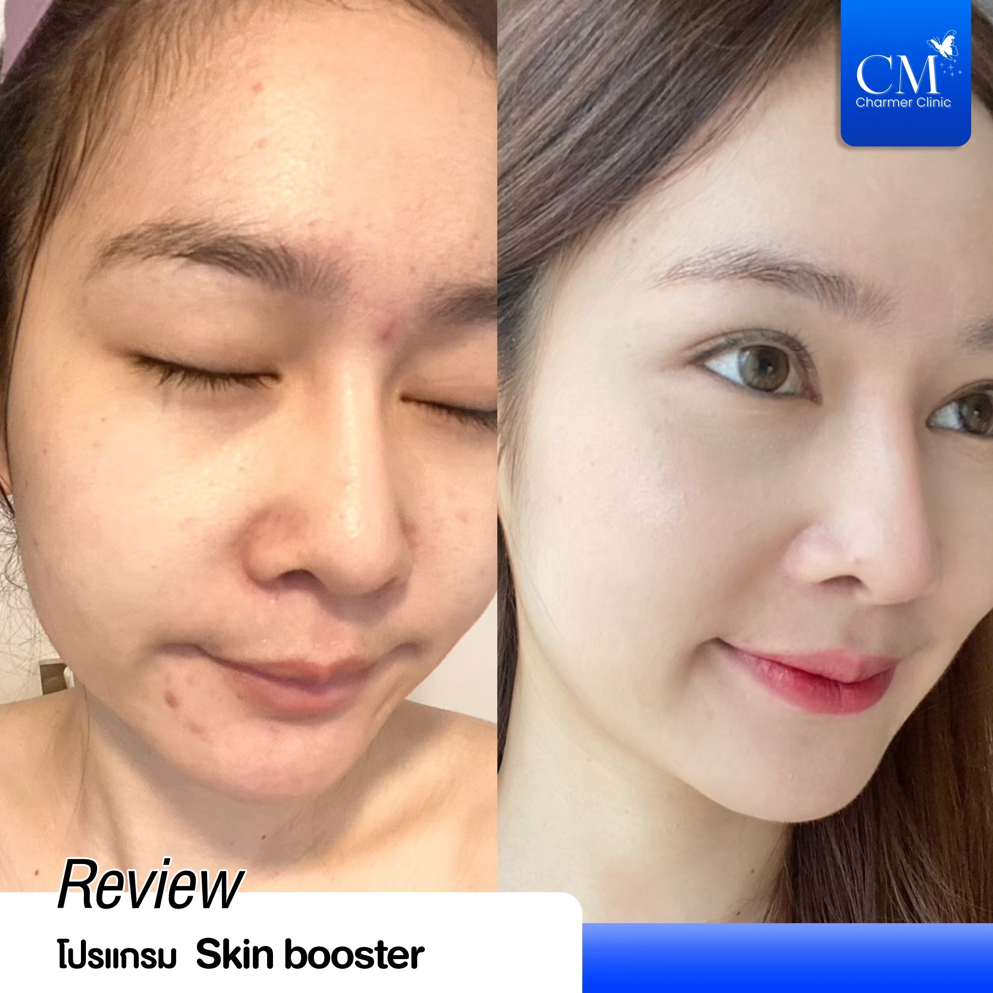 LINE_ALBUM_Graphic benz_250203_23