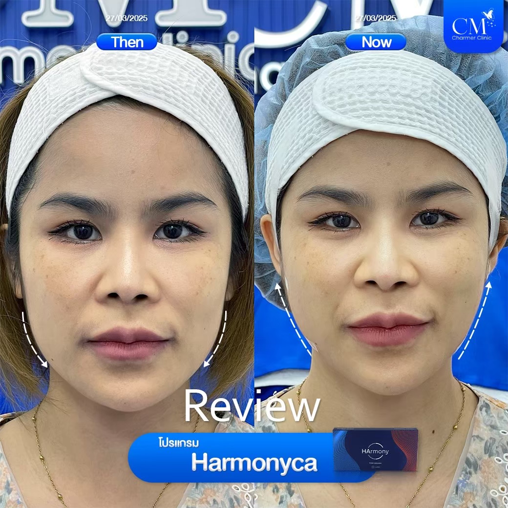 LINE ALBUM_Filler Reviews_260427_1