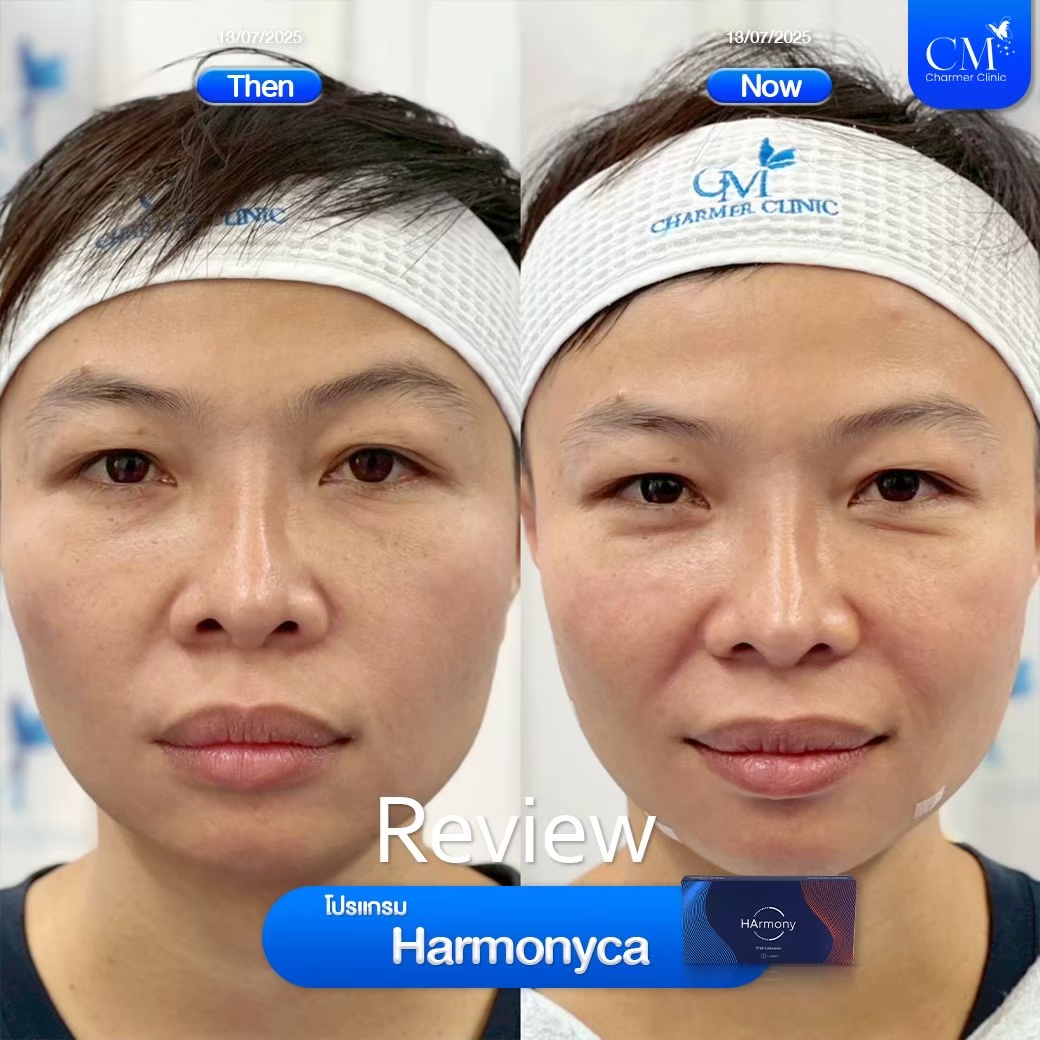 LINE ALBUM_Filler Reviews_260427_3