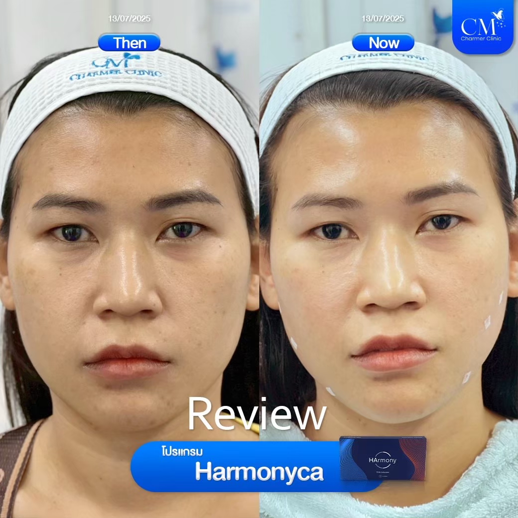 LINE ALBUM_Filler Reviews_260427_4