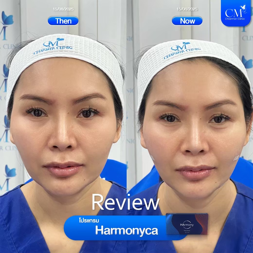 LINE ALBUM_Filler Reviews_260427_6