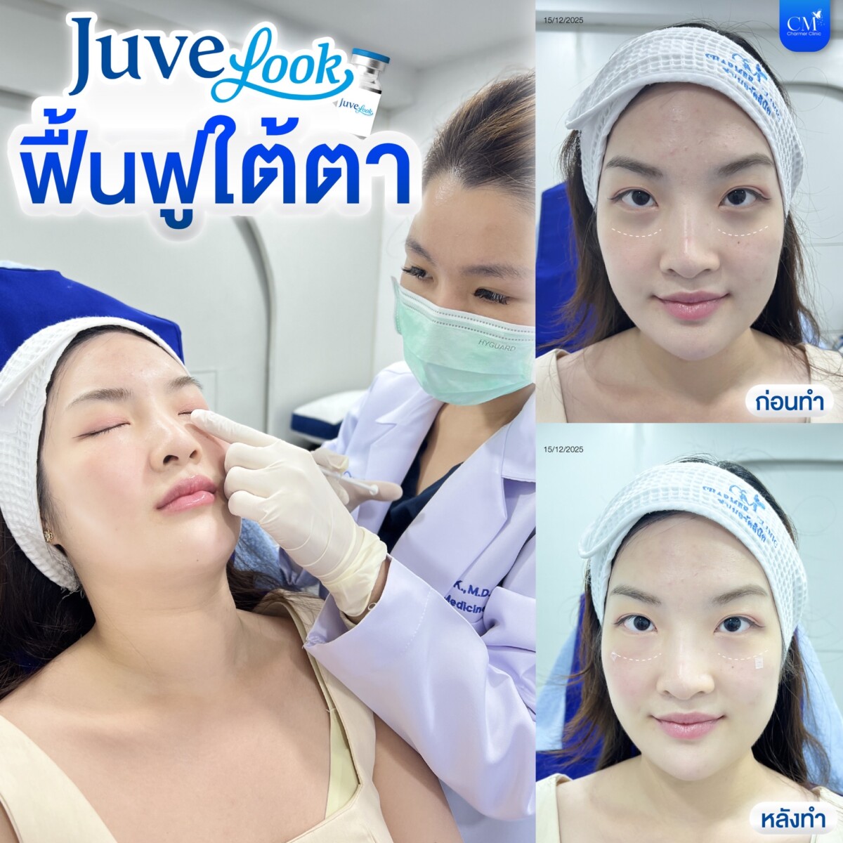 Juvelook眼霜评测。
