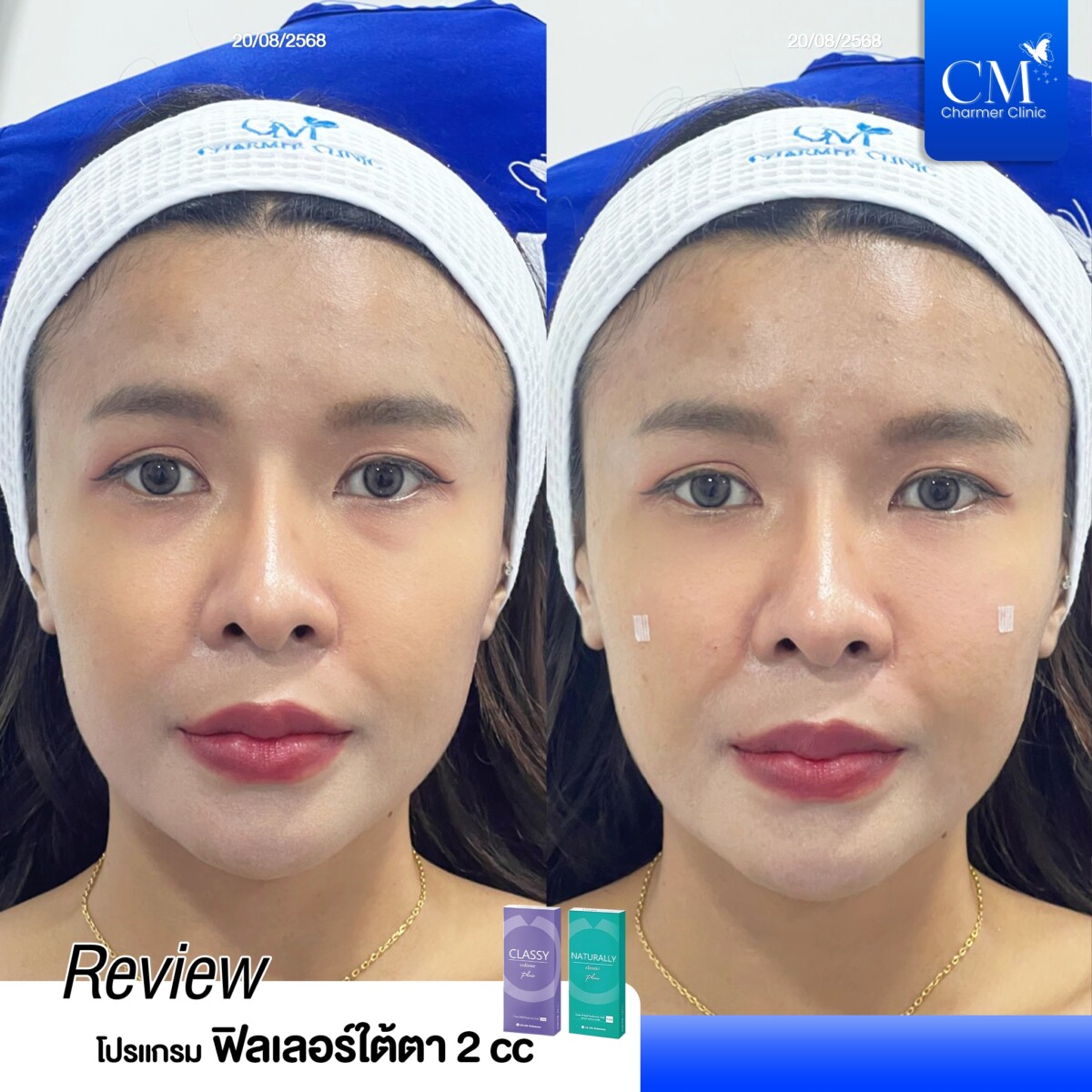 LINE_ALBUM_Graphic benz2_250829_1