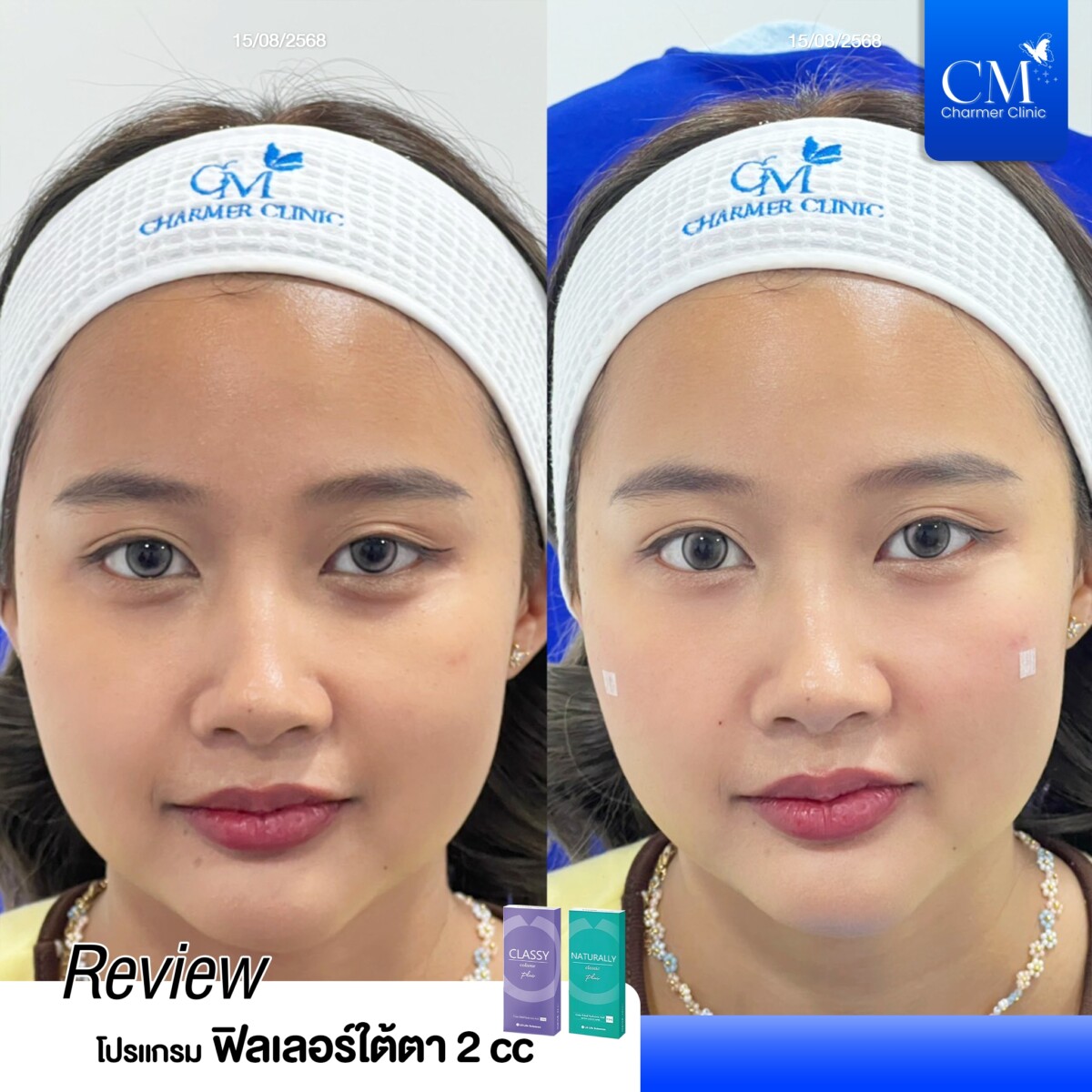 LINE_ALBUM_Graphic benz2_250829_2
