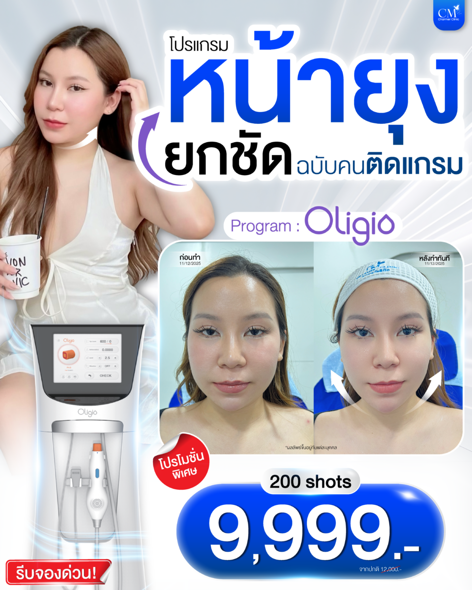Oligio升降机解决方案
